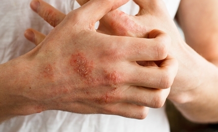 Do you Know your Obligations for Cosmetovigilance as an RP?