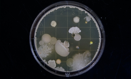 Safety Assessment of Products Subject to Microbial Contamination